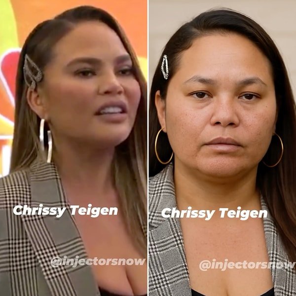 Chrissy Teigen