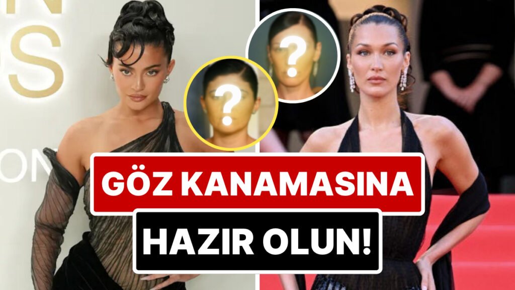 Göz Kanamasına Hazır Olun: Kylie Jenner'dan Hailey Bieber'a, Hollywood Ünlüleri Estetiksiz Nasıl Görünüyordu?