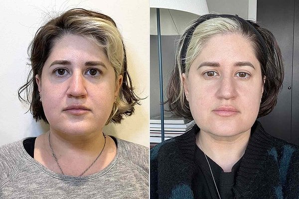 Fotoğrafla Güzellik Analizi Yaparken Dikkat Edilmesi Gerekenler