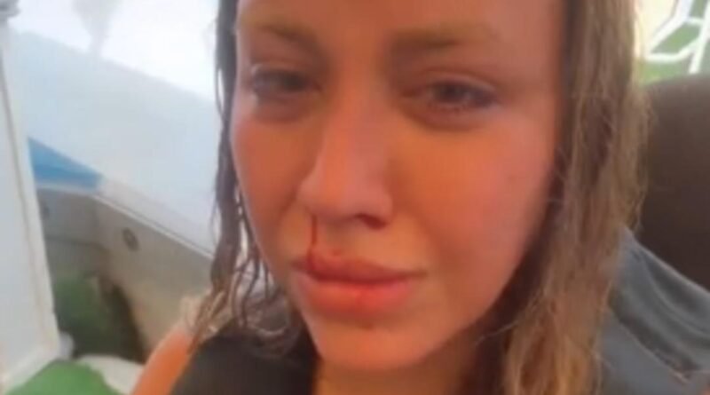 Mika Raun Oyun Aracında Kaza Geçirdi! Savrulup Kafasını Çarptı ve Kanlar İçinde Kaldı