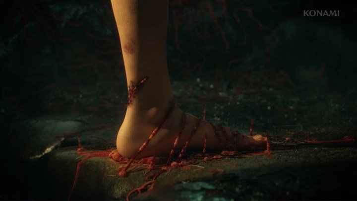 Silent Hill f Ön Yükleme Rehberi: Çıkış Tarihi, Dosya Boyutu ve Daha Fazlası!