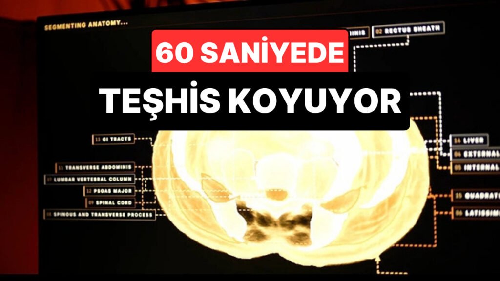 Midjourney ile Sağlık Teknolojisinde Yeni Bir Dönem: Vücudu 60 Saniyede Tarayacak Sistem