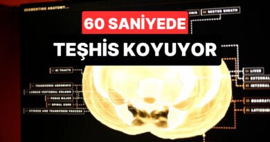 Midjourney ile Sağlık Teknolojisinde Yeni Bir Dönem: Vücudu 60 Saniyede Tarayacak Sistem