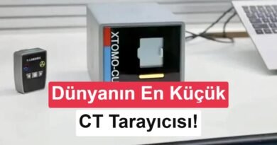 Çinli Araştırmacılar Dünyanın En Küçük CT Tarayıcısını Tasarladı